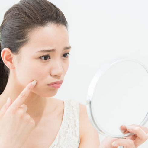 シミにお悩みのお客様